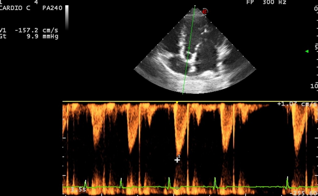 Recherche échographique de cardiopathie (sténose aortique) chez le Boxer, le Terre-Neuve, le Landseer ou encore le Bull-terrier
