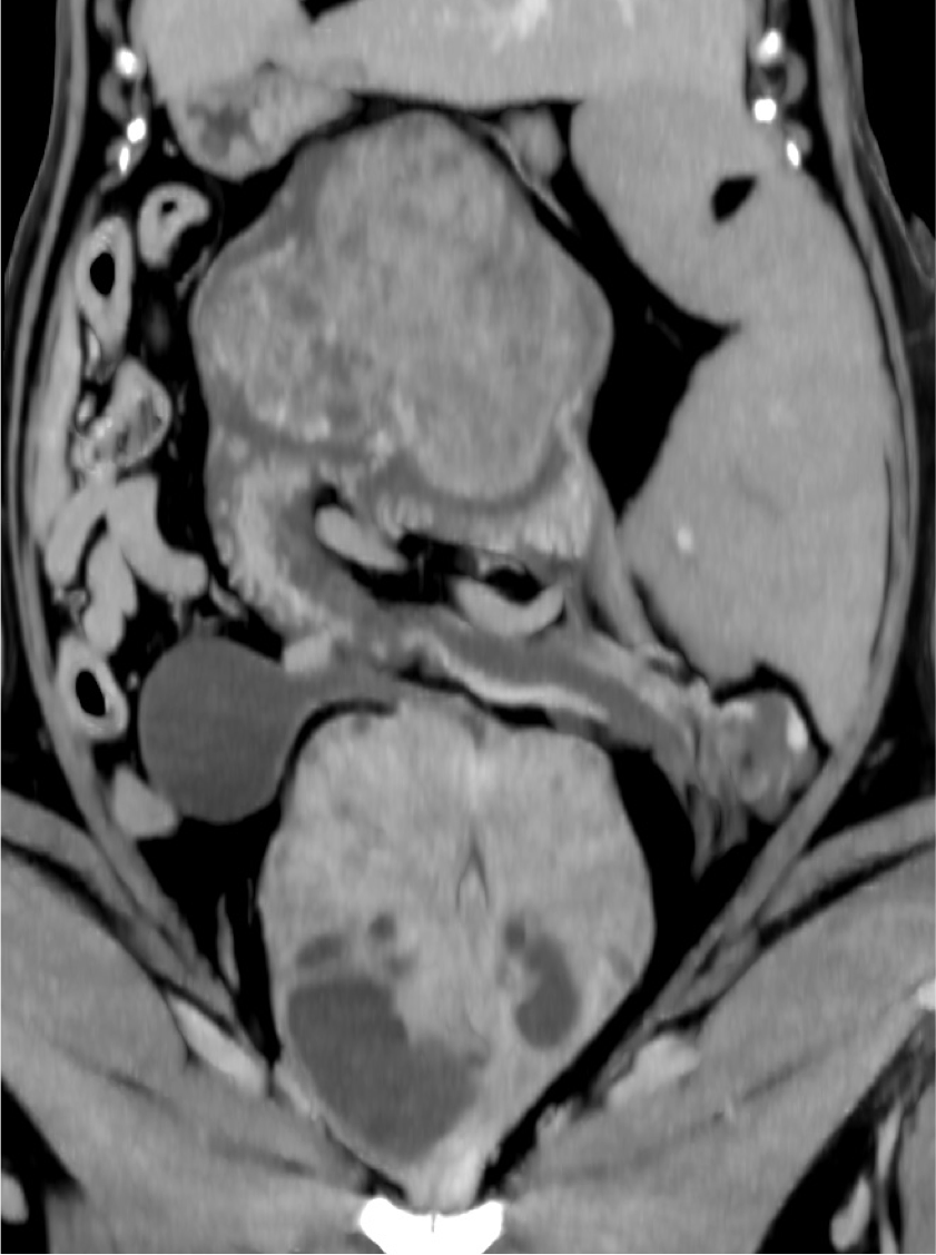 Scanner en reconstruction coronale, abdomen portion ventrale. VetRef